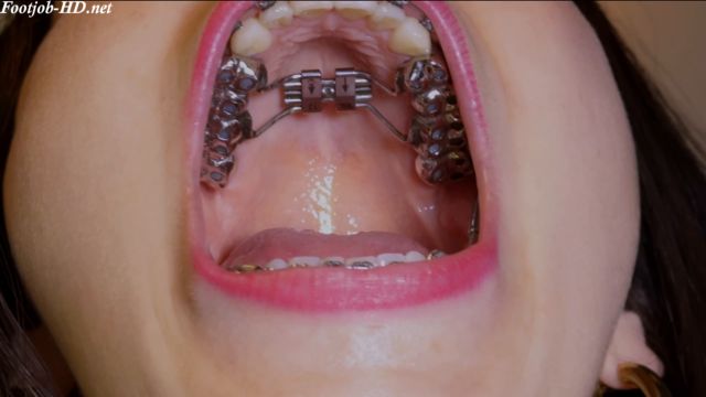 Braces Herbst & Sandal Shoejob – Shoejobparadise 00000