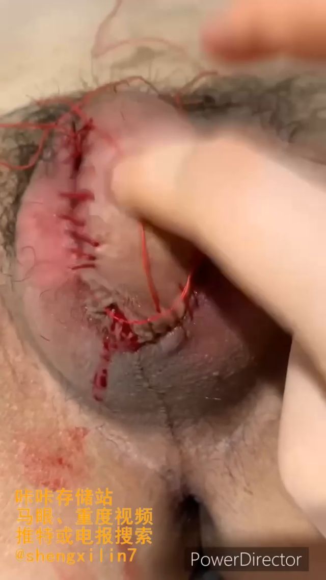 Erosmayan7 - Needle 00015