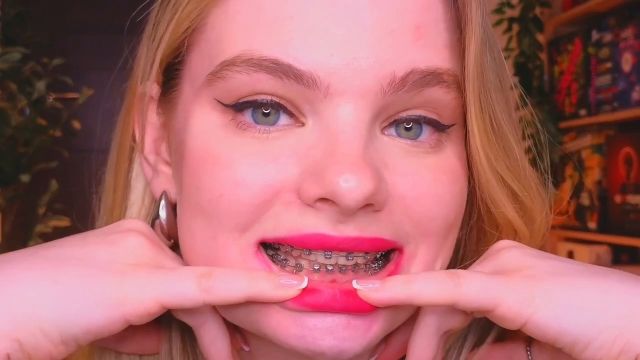 Bigass Jane - Asmr Dental Visit Check Up My Braces Carefully 00000 Bigass Jane - Asmr Dental Visit Check Up My Braces Carefully 00000