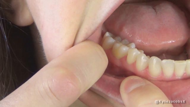 Kylie Jacobsx - After My Dentist Appointment 00000