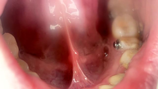 Shye White - My Clear Saliva Pov Custom 00000